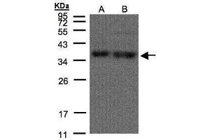WB Image Sample(30 μg of whole cell lysate) A:H1299 B:HeLa S3, 12% SDS PAGE antibody diluted at 1:500
