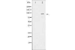 Western blot analysis of Catenin-β expression in 293 whole cell lysates,The lane on the left is treated with the antigen-specific peptide.