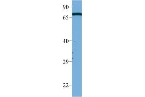 WB Suggested Anti-Masp2 Antibody Titration:  1 ug/ml  Sample Type:  HeLa