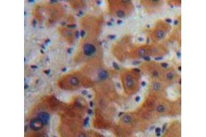 Used in DAB staining on fromalin fixed paraffin-embedded Liver tissue