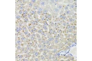 Immunohistochemistry of paraffin-embedded mouse liver using HSD17B13 Antibody.