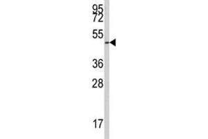 Western blot analysis of E2F1 antibody and 293 lysate.