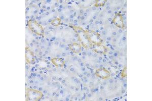 Immunohistochemistry of paraffin-embedded mouse kidney using MRPS30 Antibody (ABIN5973453) at dilution of 1/100 (40x lens). (MRPS30 anticorps)