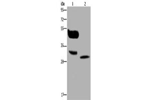 Gel: 10 % SDS-PAGE, Lysate: 40 μg, Lane 1-2: A375 cells, human lung cancer tissue, Primary antibody: ABIN7130137(MAGEA8 Antibody) at dilution 1/400, Secondary antibody: Goat anti rabbit IgG at 1/8000 dilution, Exposure time: 30 seconds (MAGEA8 anticorps)