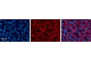 MST1 antibody - middle region          Formalin Fixed Paraffin Embedded Tissue:  Human Liver Tissue    Observed Staining:  Cytoplasm in hepatocytes   Primary Antibody Concentration:  1:100    Other Working Concentrations:  1/600    Secondary Antibody:  Donkey anti-Rabbit-Cy3    Secondary Antibody Concentration:  1:200    Magnification:  20X    Exposure Time:  0.