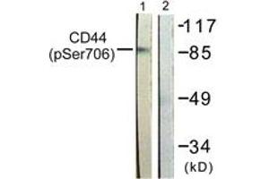 Western blot analysis of extracts from NIH-3T3 cells treated with PMA 250ng/ml 5', using CD44 (Phospho-Ser706) Antibody. (CD44 anticorps  (pSer706))