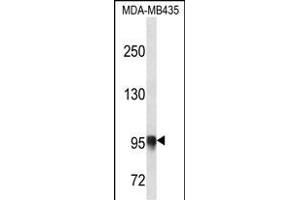 PLOD3 Antibody (N-term) (ABIN656661 and ABIN2845902) western blot analysis in MDA-M cell line lysates (35 μg/lane). (PLOD3 anticorps  (N-Term))