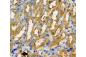 IHC-P analysis of kidney tissue, with DAB staining. (PADI3 anticorps  (AA 1-300))