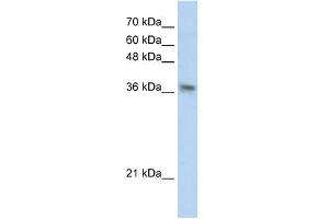 PHYHIP antibody used at 1 ug/ml to detect target protein. (PHYHIP anticorps  (N-Term))