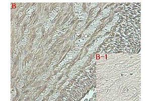 Immunohistochemical staining of human tissue using anti-DLK1 (human), mAb (PF13-3)  at 1:500 dilution. (DLK1 anticorps  (Extracellular Domain))