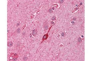 Anti-HMOX2 / Heme Oxygenase 2 antibody IHC of human brain, cortex.