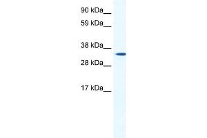 WB Suggested Anti-HOXB1 Antibody Titration:  1. (HOXB1 anticorps  (N-Term))