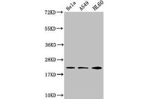 Western Blot Positive WB detected in: Hela whole cell lysate, A549 whole cell lysate, HL60 whole cell lysate All lanes: HIST1H1C antibody at 1:500 Secondary Goat polyclonal to rabbit IgG at 1/40000 dilution Predicted band size: 22 kDa Observed band size: 22 kDa (HIST1H1C anticorps)