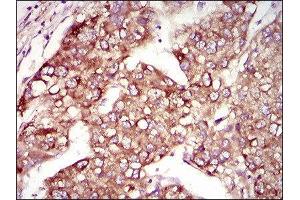 Immunohistochemistry (IHC) image for anti-Microtubule-Associated Protein 1 Light Chain 3 alpha (MAP1LC3A) (AA 1-121) antibody (ABIN1844269)