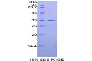SDS-PAGE analysis of Rat Nexilin Protein. (NEXN Protéine)