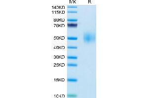 Signaling Lymphocytic Activation Molecule Family Member 1 (SLAMF1) (AA 25-242) protein (His tag)
