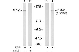 Image no. 1 for anti-Phospholipase C gamma 2 (PLCG2) (Tyr753) antibody (ABIN197402) (Phospholipase C gamma 2 anticorps  (Tyr753))