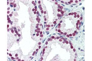 Anti-NKX3-1 antibody IHC of human prostate. (NKX3-1 anticorps  (N-Term))