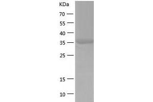 Western Blotting (WB) image for Ureidopropionase, beta (UPB1) (AA 1-384) protein (His-IF2DI Tag) (ABIN7125660)