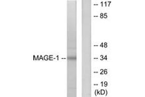 Western blot analysis of extracts from HepG2 cells, using MAGE-1 Antibody. (MAGEA1 anticorps  (AA 260-309))