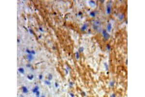 IHC-P analysis of Brain tissue, with DAB staining. (GDNF anticorps  (AA 78-211))