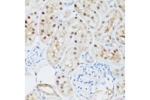 Immunohistochemistry of paraffin-embedded mouse kidney using ADK Rabbit pAb  at dilution of 1:350 (40x lens).
