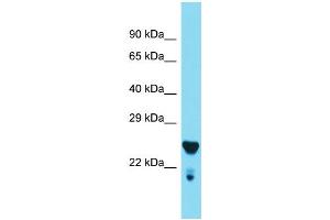 Western Blotting (WB) image for anti-Mediator Complex Subunit 29 (MED29) (Middle Region) antibody (ABIN2789154)