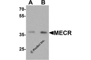 Western Blotting (WB) image for anti-Mitochondrial Trans-2-Enoyl-CoA Reductase (MECR) (C-Term) antibody (ABIN1077414) (MECR anticorps  (C-Term))