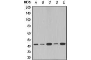 Western blot analysis of SerpinB1 expression in MCF7 (A), A549 (B), mouse lung (C), mouse spleen (D), rat spleen (E) whole cell lysates.