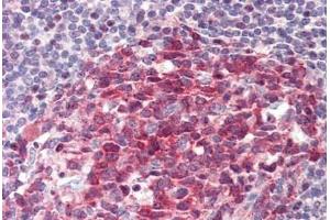 Human Tonsil: Formalin-Fixed, Paraffin-Embedded (FFPE)