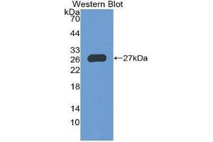 Western Blotting (WB) image for anti-Forkhead Box P1 (FOXP1) (AA 461-671) antibody (ABIN2119330) (FOXP1 anticorps  (AA 461-671))