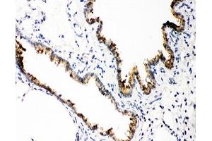 IHC-P: GSTP1 antibody testing of rat lung tissue (GSTP1 anticorps  (AA 2-210))