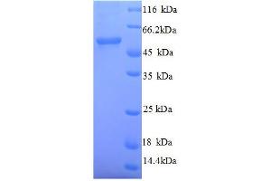 SDS-PAGE (SDS) image for SMAD, Mothers Against DPP Homolog 2 (SMAD2) (AA 2-467), (full length) protein (His tag) (ABIN1047400)