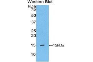 Western Blotting (WB) image for anti-S100 Calcium Binding Protein A7 (S100A7) (AA 1-108) antibody (ABIN1860486) (S100A7 anticorps  (AA 1-108))