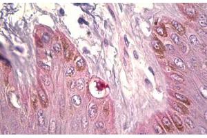 Anti-DCT antibody IHC staining of human skin, melanocytes. (DCT anticorps  (AA 51-100))