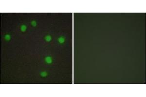 Immunofluorescence analysis of HUVEC cells, using NKX6. (NK6 Homeobox 3 anticorps  (Internal Region))