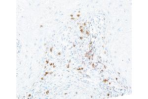 Immunohistochemistry (IHC) image for anti-Inducible T-Cell Co-Stimulator (ICOS) (AA 149-199) antibody (ABIN7453973) (Recombinant ICOS anticorps  (AA 149-199))