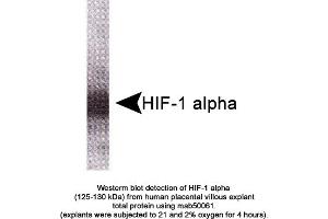 Image no. 1 for anti-Hypoxia Inducible Factor 1, alpha Subunit (Basic Helix-Loop-Helix Transcription Factor) (HIF1A) (AA 329-530) antibody (ABIN363215)