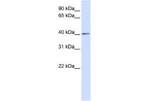 WB Suggested Anti-NKX3-2 Antibody Titration: 0. (NKX3-2 anticorps  (Middle Region))
