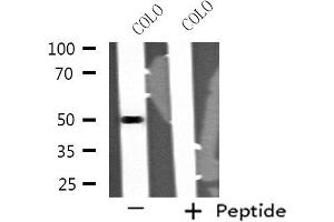 Western blot analysis of extracts from COLO cells, using STK24 antibody. (STK24 anticorps  (N-Term))