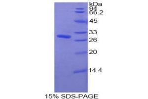 SDS-PAGE analysis of Human Pyridoxal Kinase Protein. (PDXK Protéine)