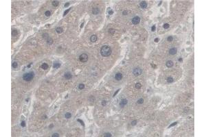 Detection of AZIN1 in Human Liver Tissue using Polyclonal Antibody to Antizyme Inhibitor 1 (AZIN1) (Antizyme Inhibitor 1 anticorps  (AA 5-290))