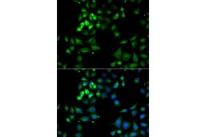 Immunofluorescence analysis of A549 cell using HYOU1 antibody. (HYOU1 anticorps)