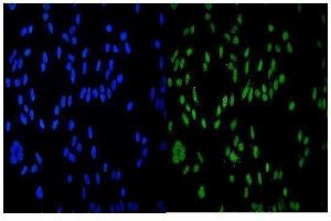 IF analysis of HDAC9 using anti-HDAC9 antibody (ABIN7602333).