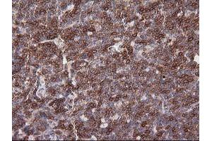 Immunohistochemistry (IHC) image for anti-T-cell surface glycoprotein CD1c (CD1C) antibody (ABIN2670658) (CD1c anticorps)