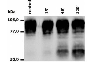 Western Blotting analysis of PMA-activated neutrophils (Fig. (Integrin beta 2 anticorps  (APC))