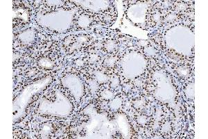 IHC analysis of C1orf77/FOP/CHTOP using anti-C1orf77/FOP/CHTOP antibody (ABIN7603201). (CHTOP anticorps  (N-Term))