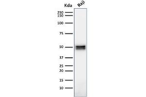 Western Blot Analysis of Raji cell lysate using CD79a Mouse Monoclonal Antibody (HM47/A9). (CD79a anticorps  (AA 202-216))