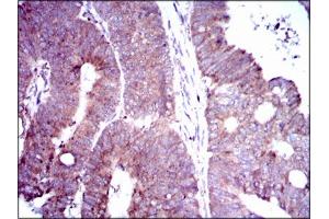 Image no. 2 for anti-delta-Like 4 (DLL4) antibody (ABIN1491404)