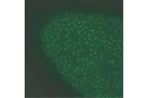 High magnification view of A.